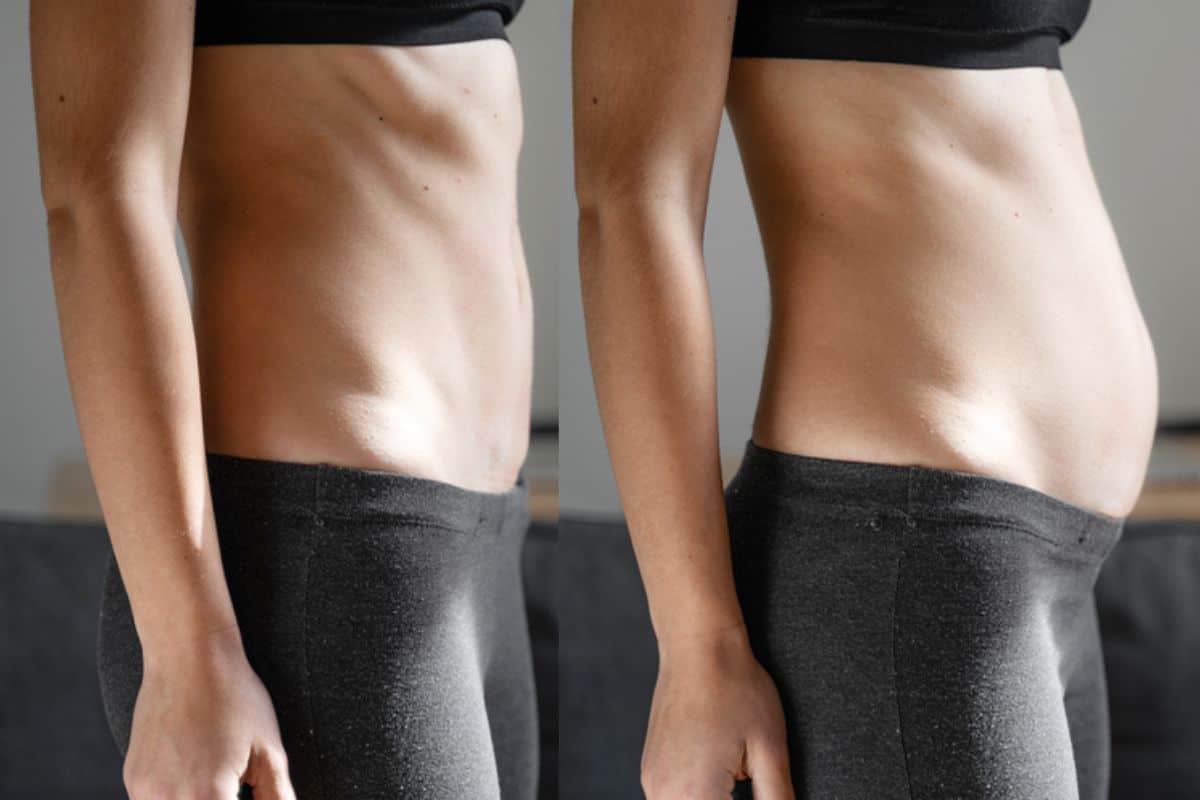 How long does diastasis recti take to improve Royal Leamington Spa?