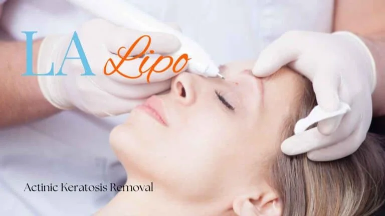 Woman receiving Actinic Keratosis Removal Treatment Royal Leamington Spa